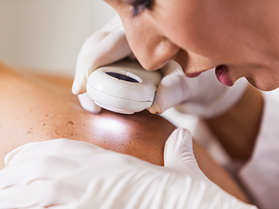 U.S. FDA Grants Accelerated Approval For Iovance’s Skin Cancer Therapy